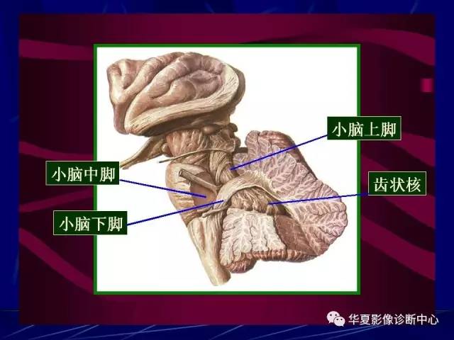 脑干解剖复习