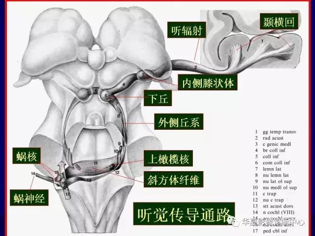 脑干解剖复习