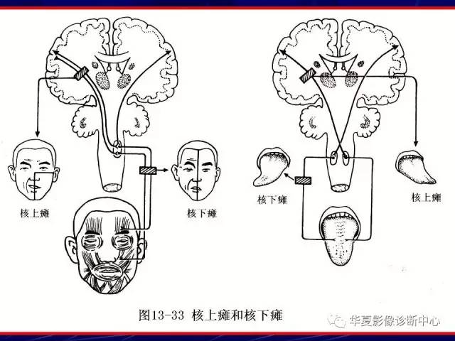 脑干解剖复习
