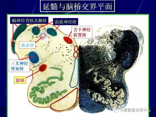 脑干解剖复习