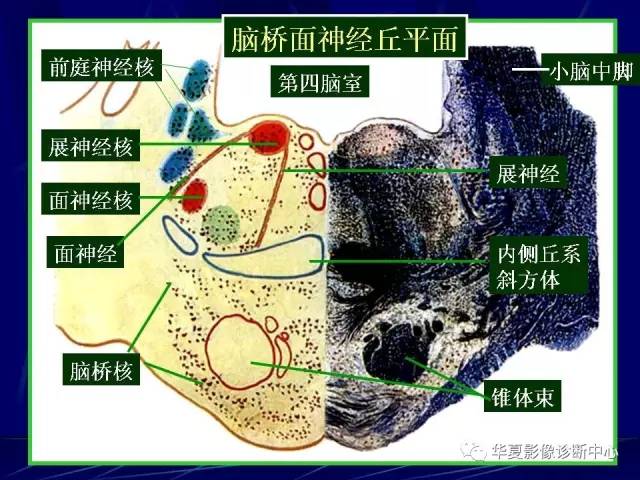 脑干解剖复习