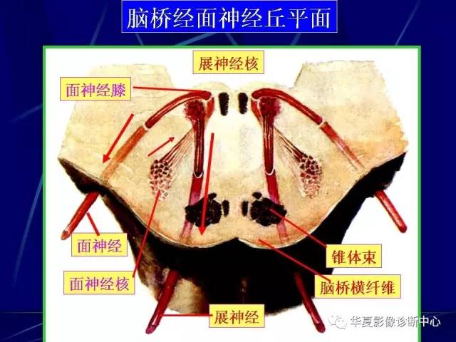 脑干解剖复习