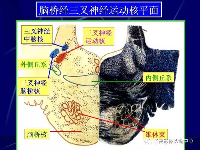 脑干解剖复习