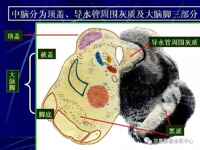 脑干解剖复习