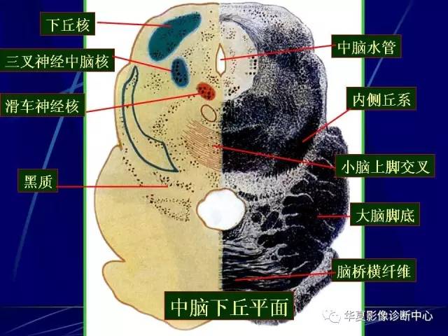 脑干解剖复习