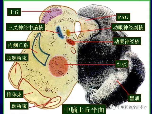 脑干解剖复习