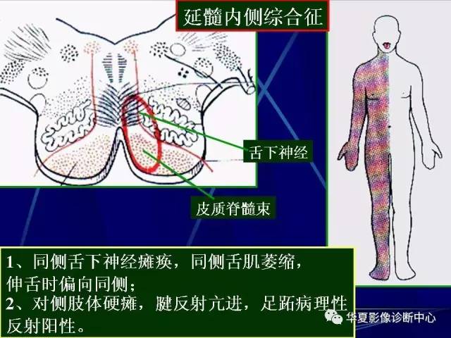 脑干解剖复习