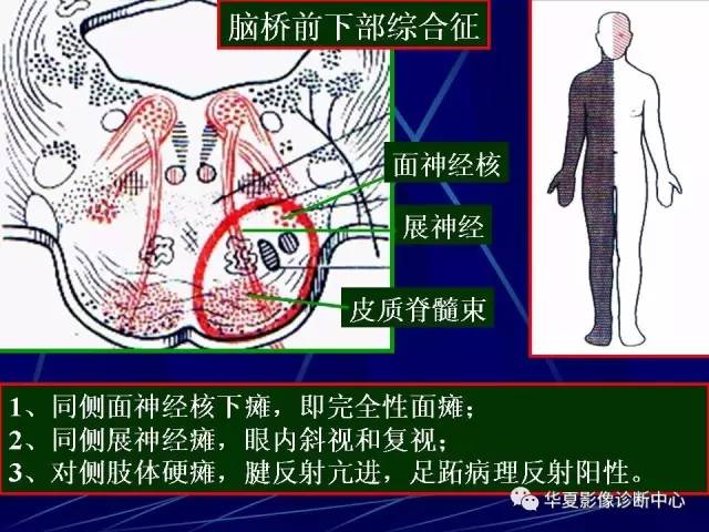 脑干解剖复习