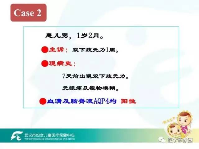 【PPT】小儿NMOSD及其相关疾病MRI诊断思路