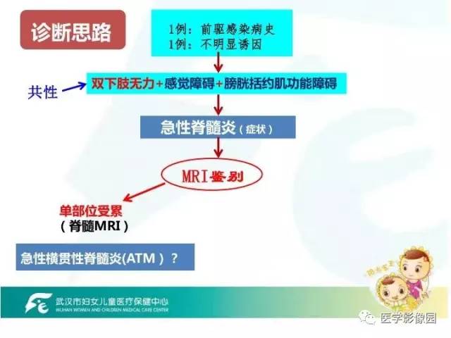 【PPT】小儿NMOSD及其相关疾病MRI诊断思路