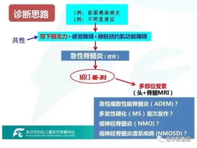 【PPT】小儿NMOSD及其相关疾病MRI诊断思路