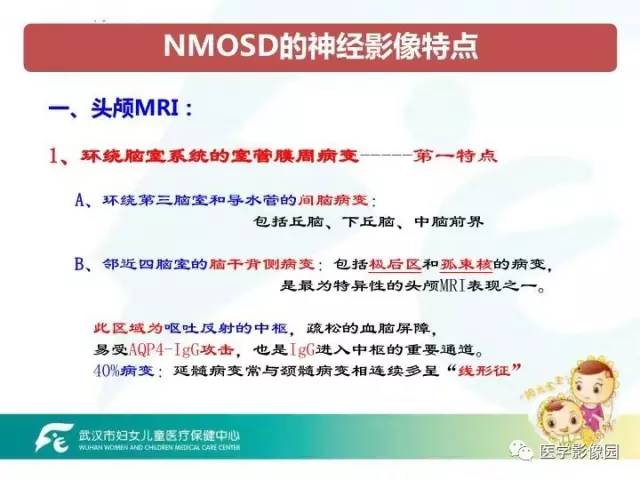 【PPT】小儿NMOSD及其相关疾病MRI诊断思路