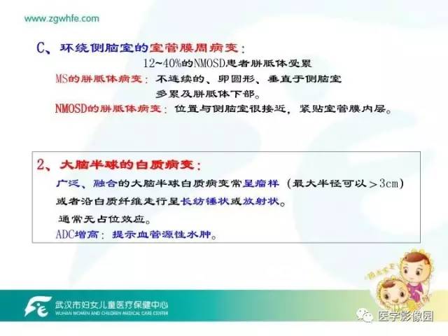 【PPT】小儿NMOSD及其相关疾病MRI诊断思路