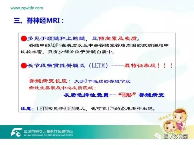 【PPT】小儿NMOSD及其相关疾病MRI诊断思路