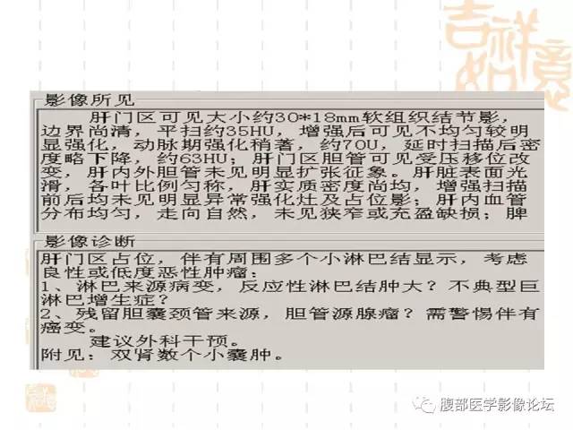 【病例】残留胆囊颈管癌1例CT及MR影像表现 【病例】残留胆囊颈管癌1例CT及MR影像表现