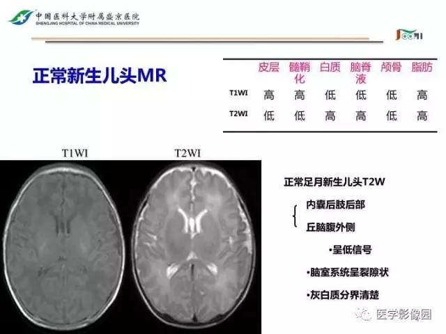 【PPT】常见新生儿脑损伤的MRI检查序列的选择与诊断要点