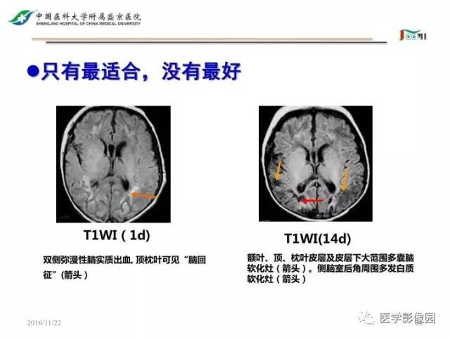 【PPT】常见新生儿脑损伤的MRI检查序列的选择与诊断要点