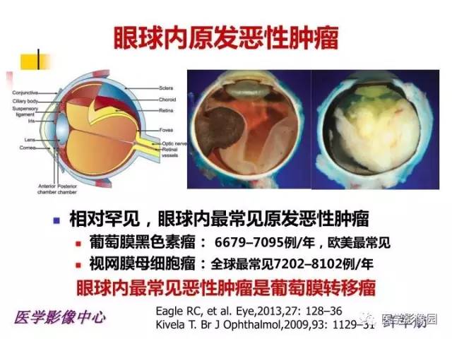【PPT】儿童RB影像诊断分析思路