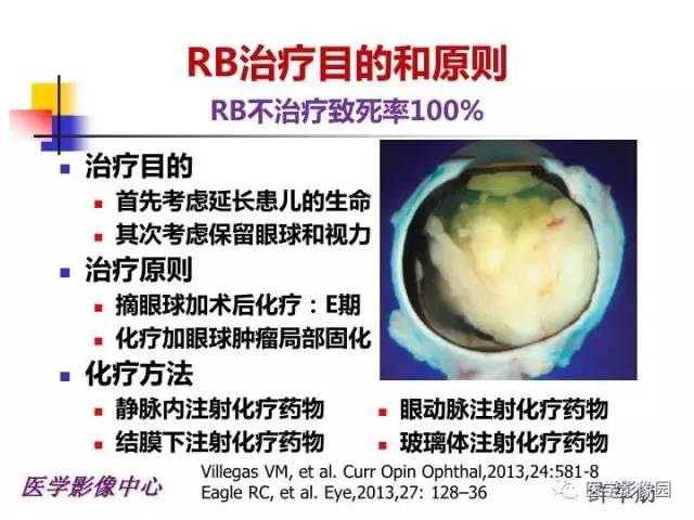 【PPT】儿童RB影像诊断分析思路