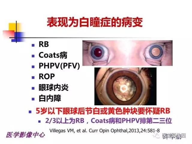 【PPT】儿童RB影像诊断分析思路