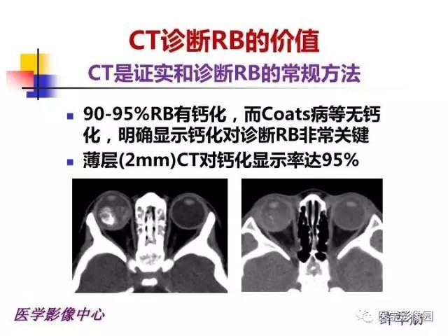 【PPT】儿童RB影像诊断分析思路