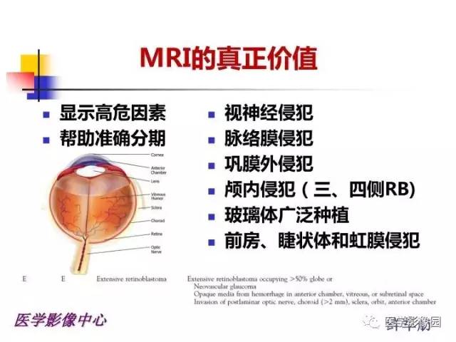 【PPT】儿童RB影像诊断分析思路