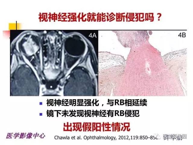 【PPT】儿童RB影像诊断分析思路