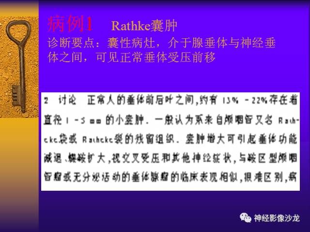 【病例】鞍区病变6例CT及MR