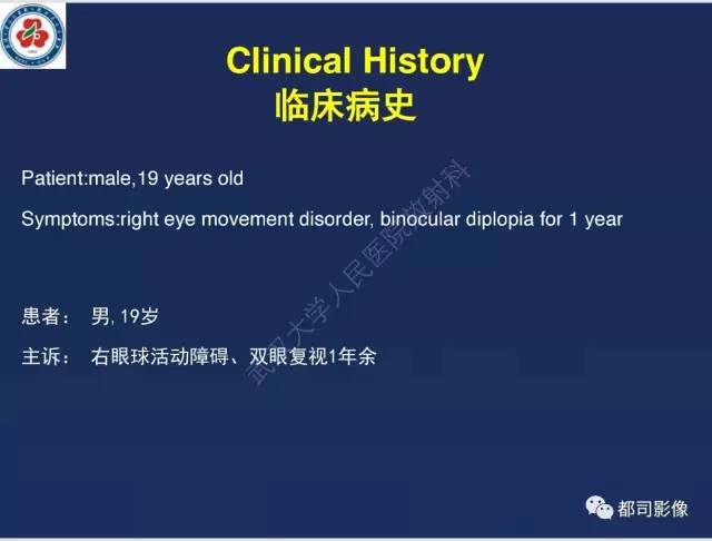 【病例】颅底软骨肉瘤1例CT及MR影像诊断