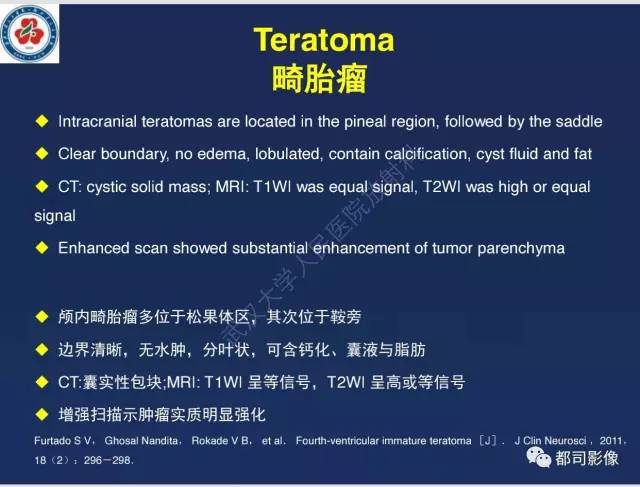 【病例】颅底软骨肉瘤1例CT及MR影像诊断