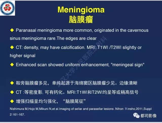 【病例】颅底软骨肉瘤1例CT及MR影像诊断