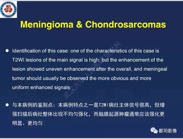 【病例】颅底软骨肉瘤1例CT及MR影像诊断