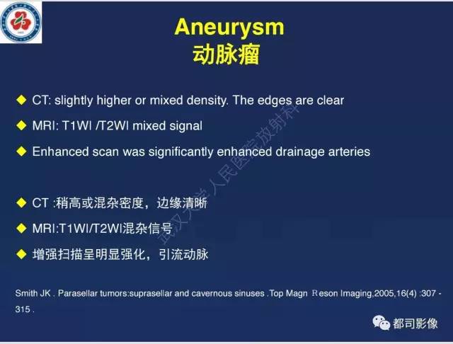 【病例】颅底软骨肉瘤1例CT及MR影像诊断
