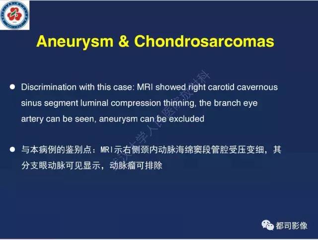 【病例】颅底软骨肉瘤1例CT及MR影像诊断