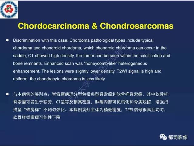 【病例】颅底软骨肉瘤1例CT及MR影像诊断