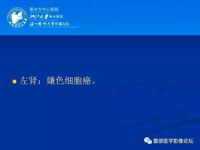 【病例】肾嫌色细胞癌1例CT影像表现 【病例】肾嫌色细胞癌1例CT影像表现