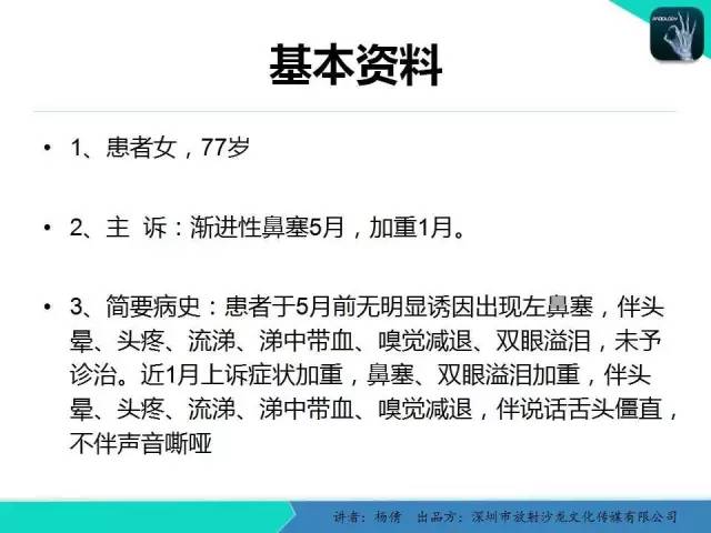 【病例】鼻腔-鼻窦乳头状瘤1例CT影像表现