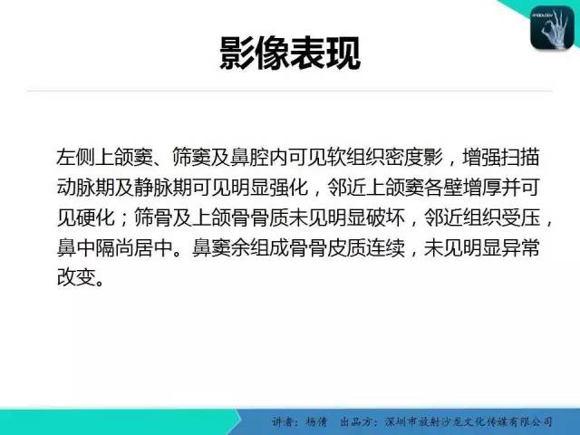 【病例】鼻腔-鼻窦乳头状瘤1例CT影像表现