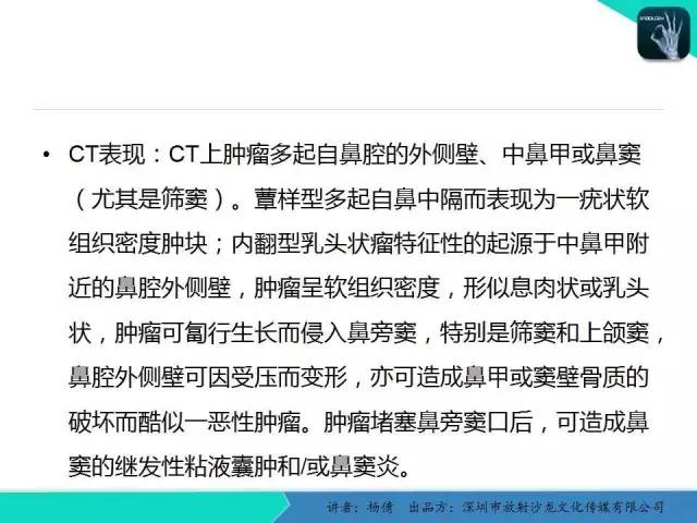 【病例】鼻腔-鼻窦乳头状瘤1例CT影像表现