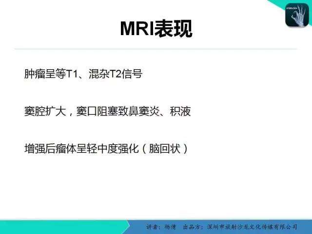 【病例】鼻腔-鼻窦乳头状瘤1例CT影像表现