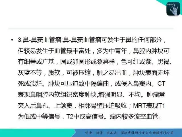 【病例】鼻腔-鼻窦乳头状瘤1例CT影像表现