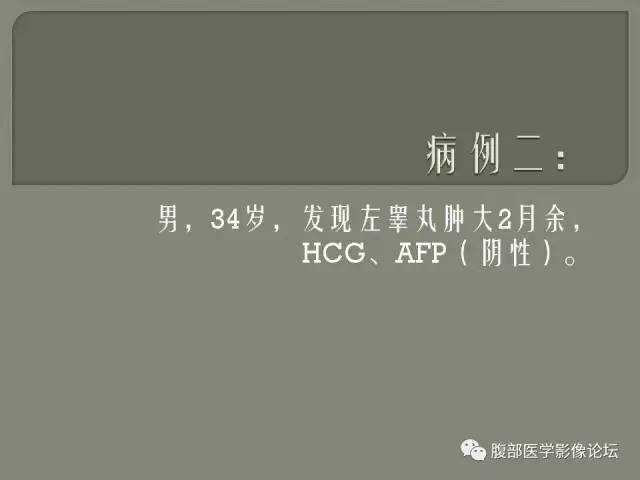 【病例】睾丸淋巴瘤VS精原细胞瘤 【病例】睾丸淋巴瘤VS精原细胞瘤