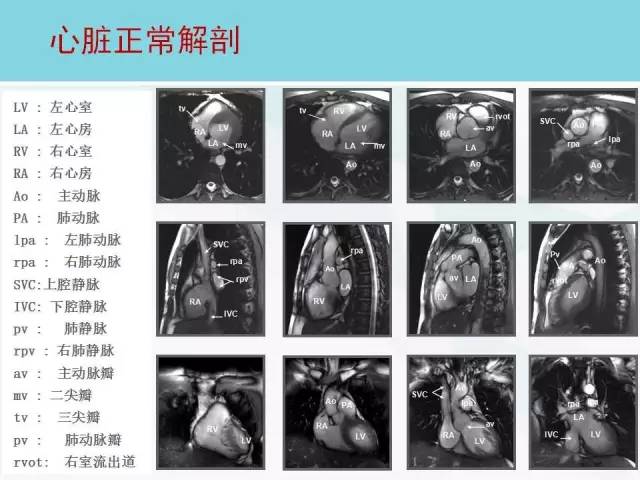 【PPT】心脏MRI定位攻略