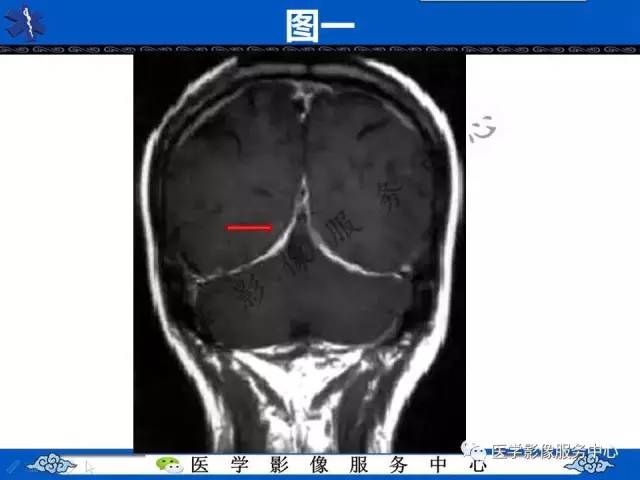 【今日征象】奔驰征