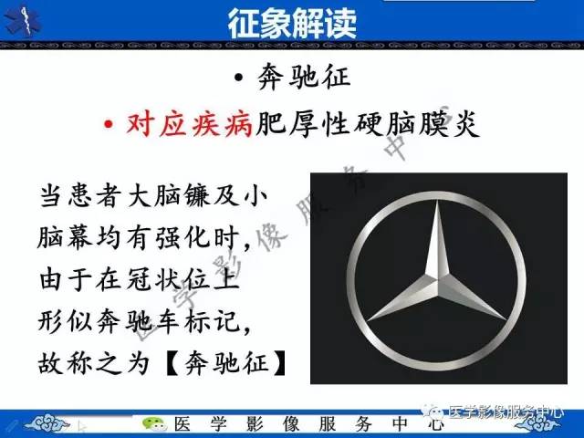 【今日征象】奔驰征