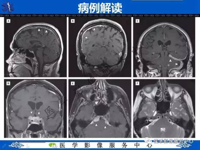 【今日征象】奔驰征