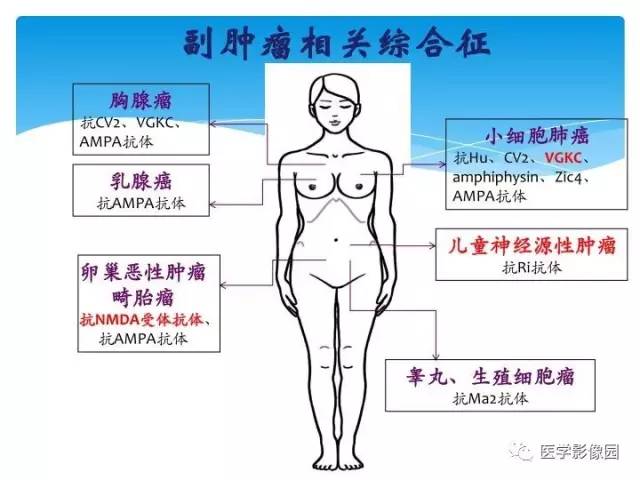 【PPT】儿童免疫性脑炎的临床及MR征象
