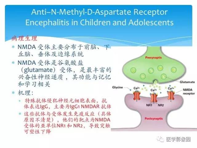 【PPT】儿童免疫性脑炎的临床及MR征象