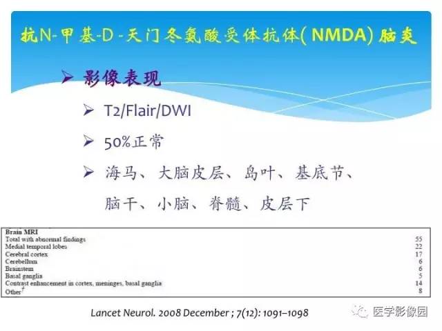 【PPT】儿童免疫性脑炎的临床及MR征象