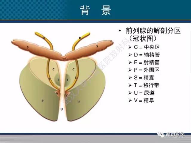 【PPT】男性下泌尿生殖道囊肿影像学鉴别诊断